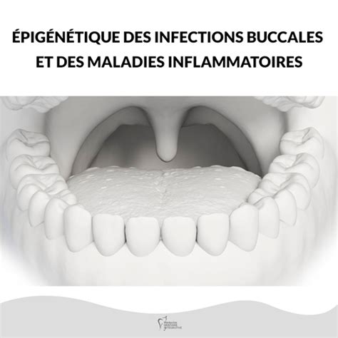 Épigénétique Des Infections Buccales Et Des Maladies Inflammatoires