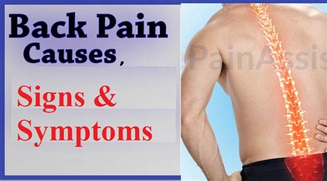 Back Pain Common Causes Signs And Symptoms Medical Estudy