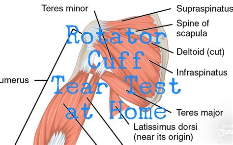 Rotator Cuff Tear Test At Home Power Chiropractic