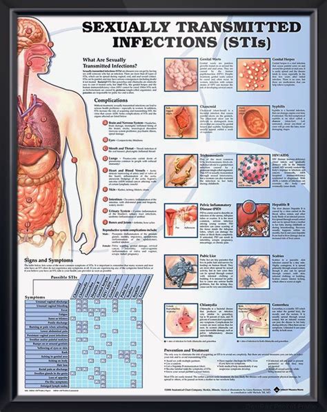 Sexually Transmitted Infections Chart X Medical Education