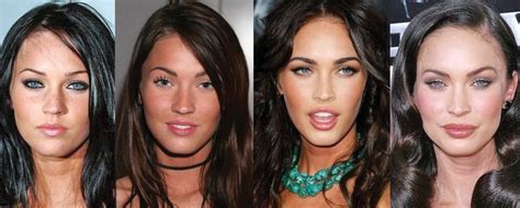 megan fox plastic surgery before and after pictures 2020