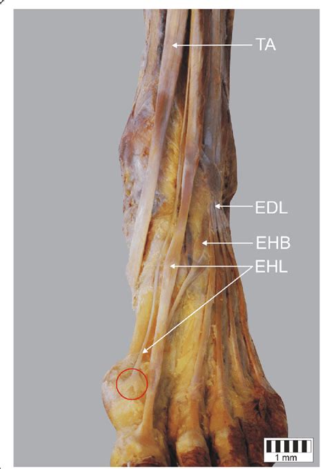 Extensor Hallucis Longus Anatomy