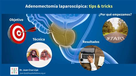 Adenomectomia Lap2 By Ariadna Ilacqua