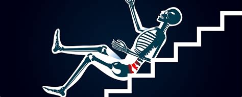 Do you really have a hairline that's receding? How Long Does A Tailbone Injury Take To Heal - Sports ...