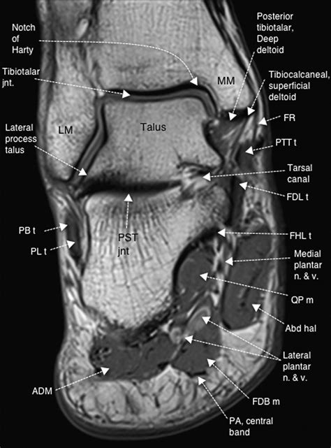 Normal Magnetic Resonance Imaging Anatomy Of The Ankle And Foot