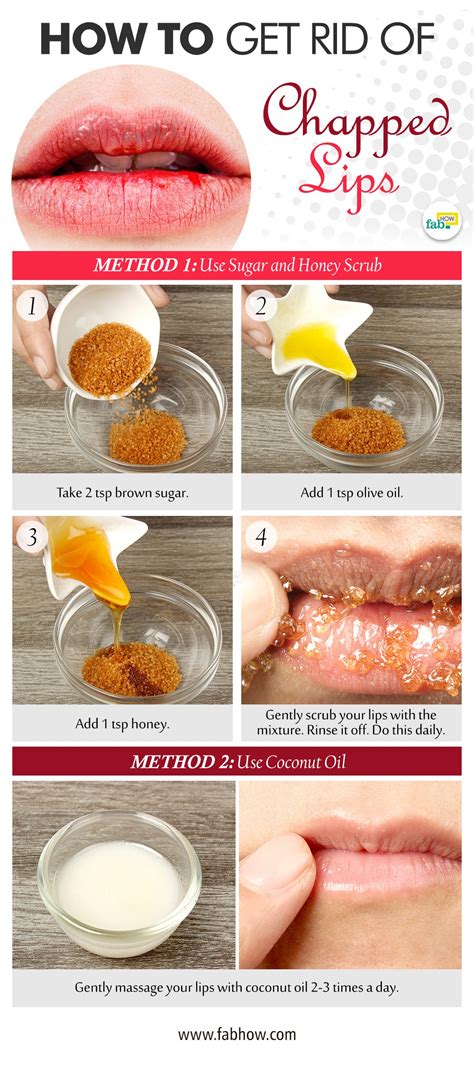 How To Get Rid Of Chapped Lips 4 Easy Methods Fab How
