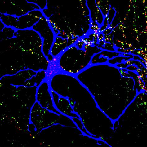 Autism Linked Proteins Help Wire The Brain Neuroscience News