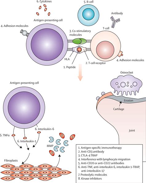 Juvenile Idiopathic Arthritis The Lancet