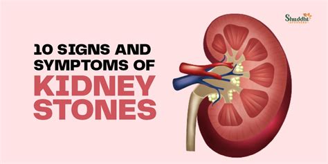 10 Signs And Symptoms Of Kidney Stones Shuddhi Ayurveda
