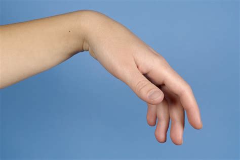 Filetenodese Hand Wikimedia Commons
