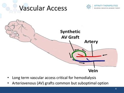 Vascular Access Long Term Vascular