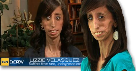 Lizzie Velasquez Answers Bullies Who Branded Her The Worlds Ugliest