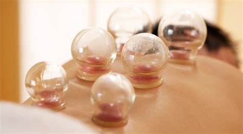 6 Things To Know About Cupping Therapy Muscle And Fitness