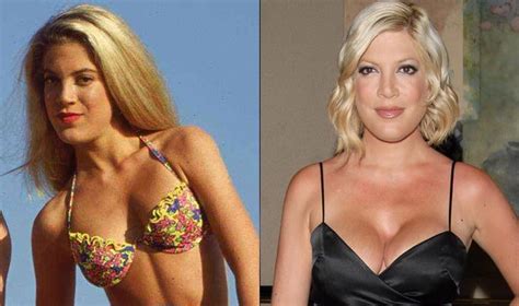 Tori Spelling Plastic Surgery Before And After Pictures Hot Sex Picture