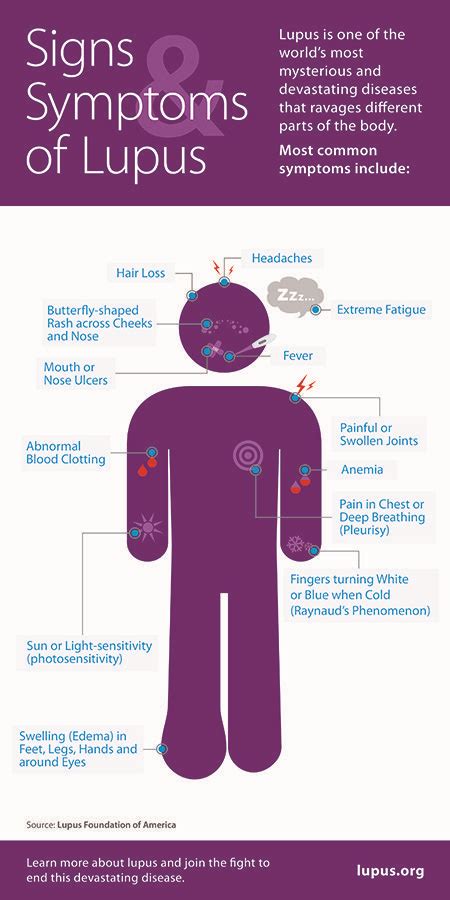 Study Shows Lupus Patients Suffer In Silence Click The Infographic To