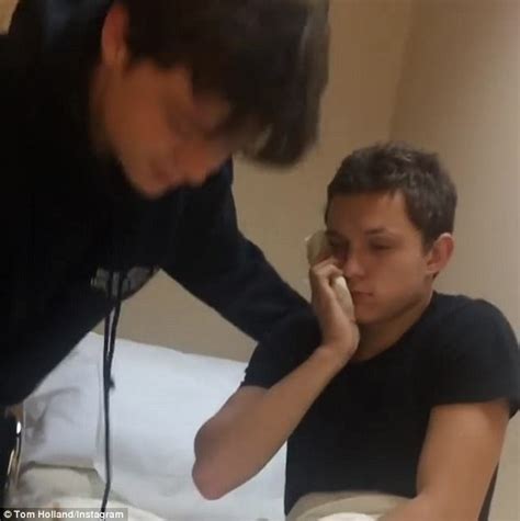 Tom Holland Dazed And Confused After Wisdom Teeth Removal Daily Mail