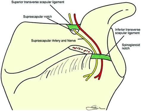 Transverse Scapular Ligament