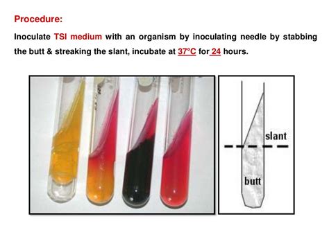 Biochemical Tests