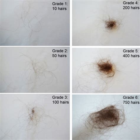 Grades 16 Of The Sinclair Hair Shedding Scale Download Scientific