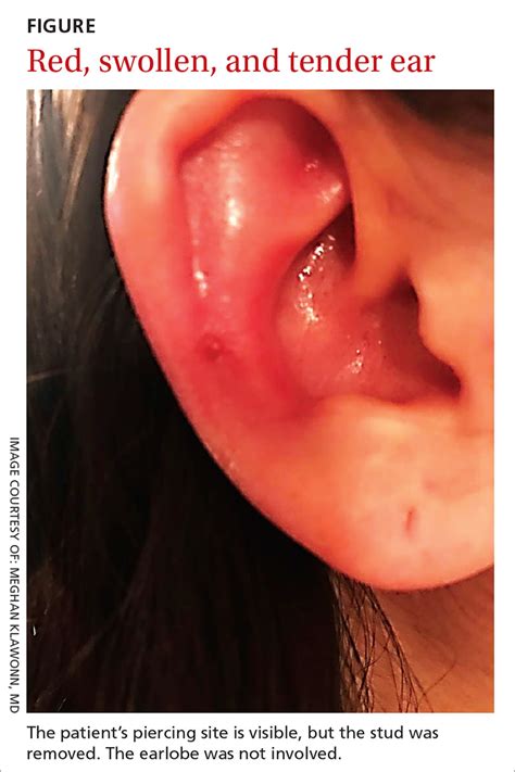 Is your cat scratching their ears or shaking their head? Erythematous swollen ear | MDedge Family Medicine