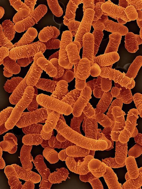 Lactobacillus Salivarius Photograph By Dennis Kunkel Microscopyscience