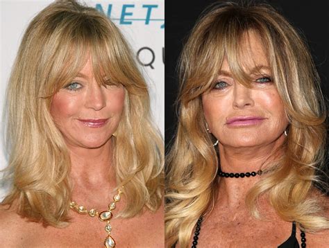 The editors of publications international, ltd. Did Goldie Hawn Get Plastic Surgery? Face Before and After