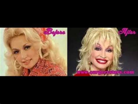 Dolly Parton Before and After Plastic Surgery - YouTube