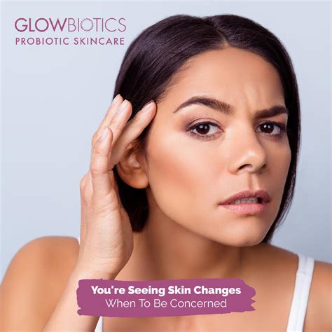 Skin Spots To Worry About When To Be Concerned Glowbiotics