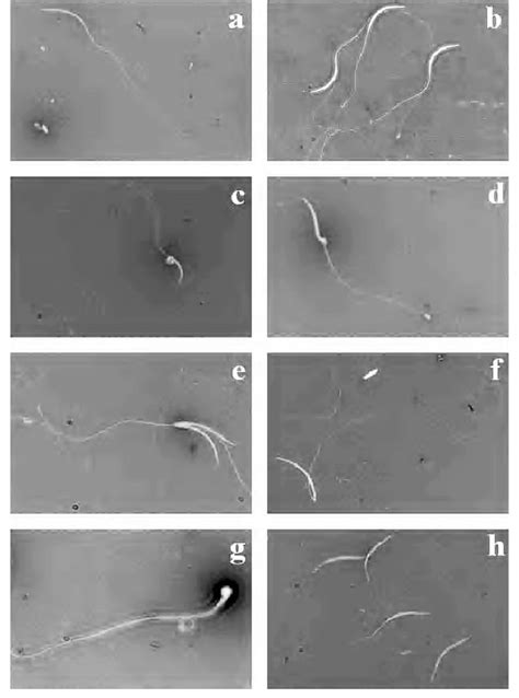 Classes Of Spermatozoa Morphology A Morphologically Normal B