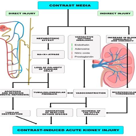 Proposed Mechanism Of Contrast Induced Acute Kidney Injury Download