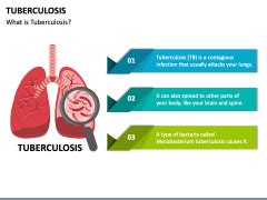 Tuberculosis Powerpoint Template Ppt Slides