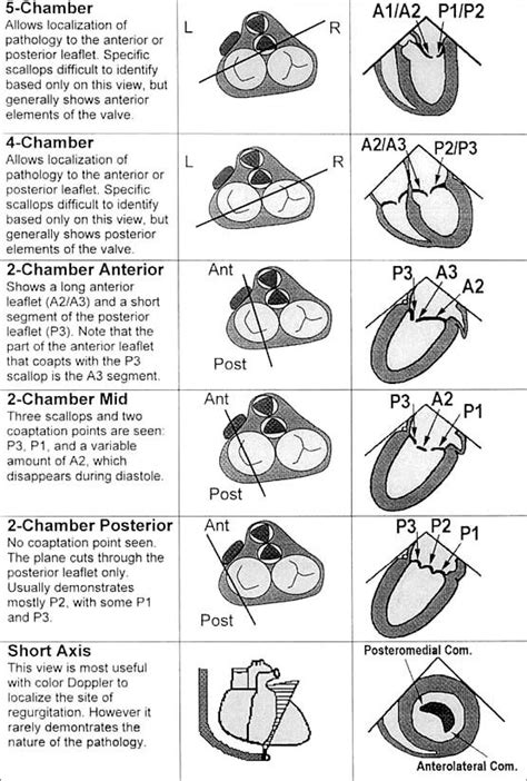 8 Best Mitral Valve Images On Pinterest Mitral Valve Cardiology And