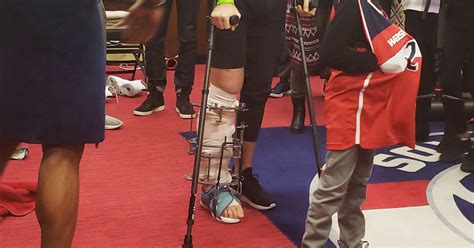 When @redskins qb alex smith broke his leg in 2018, no one thought it would take 17 surgeries to fix. Alex Smith Shows Off Leg With Multiple Rods Sticking Out ...