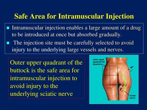 Ppt The Gluteal Region Buttock Powerpoint Presentation Id