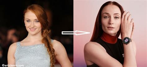 Sophie Turner Plastic Surgery Before And After Photos