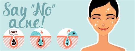 There are several strategies you can use to make a bruise go away faster. SOS SPOT KILLER - How to get rid of pimples overnight ...