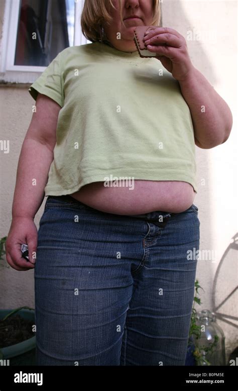 Ein Starkes Übergewicht Weibchen Essen Eine Schokoladen Eis Bar Krankhaft Fettleibig Mit Magen