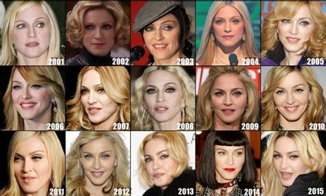 Madonna E La Chirurgia Estetica Rifatti Chirurgia Estetica Vip