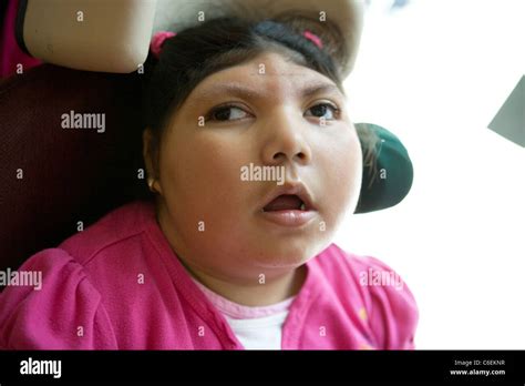 Deaf Blind Seven Year Old Girl Portrait Stock Photo Alamy