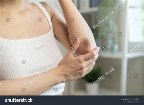 Close Stain Bruise Wound On Arm Stock Photo 2249636261 Shutterstock
