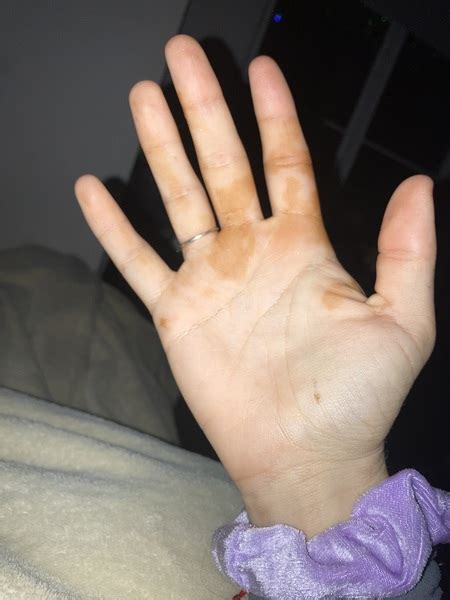 Rust Colored Stains On Hands Overnight Asking List