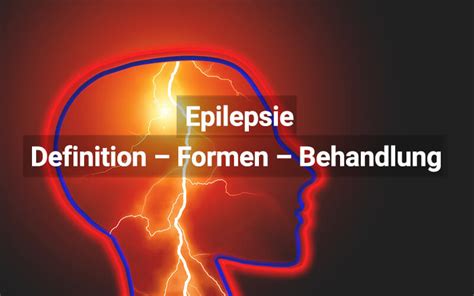 Epilepsie Symptome Ursachen Therapie Praktischarzt