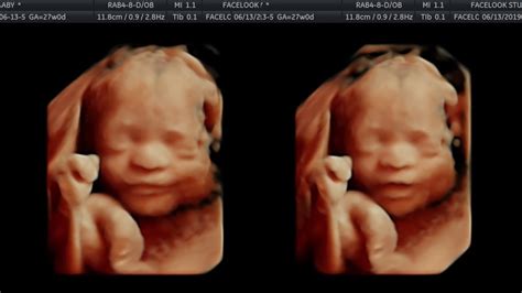 Our Babys 4d Ultrasound 27 Weeks Pregnant Youtube