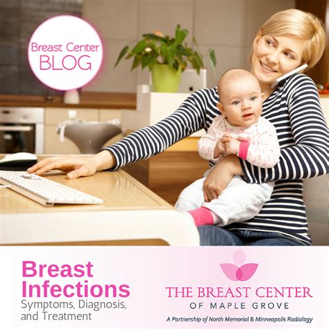 Breast Infections Breast Center Mn Maple Grove