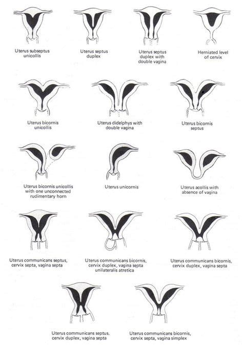 Differet Types Of Uterus Diagram Anatomynote Com Ultrasound My Xxx Hot Girl