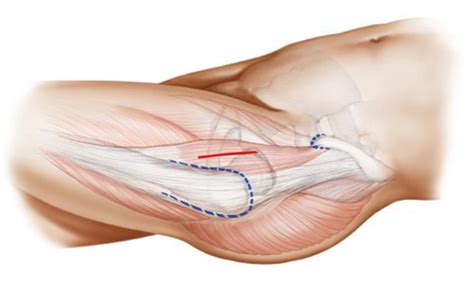 The surface of this ramus is. 8 The anterior superior iliac spine is located and ...