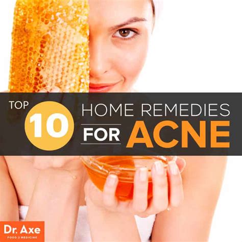 10 Home Remedies For Acne That Work Dr Axe