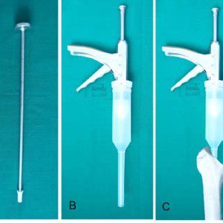 (A) The Extended trochanteric osteotomy is performed by cutting from