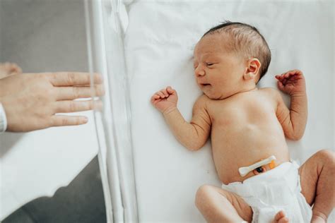 5 Tips On Caring For Your Babys Umbilical Cord Tinyhood
