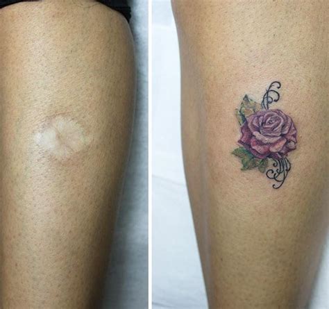 10 Amazing Tattoos That Turn Scars Into Works Of Art Amazing Tattoos